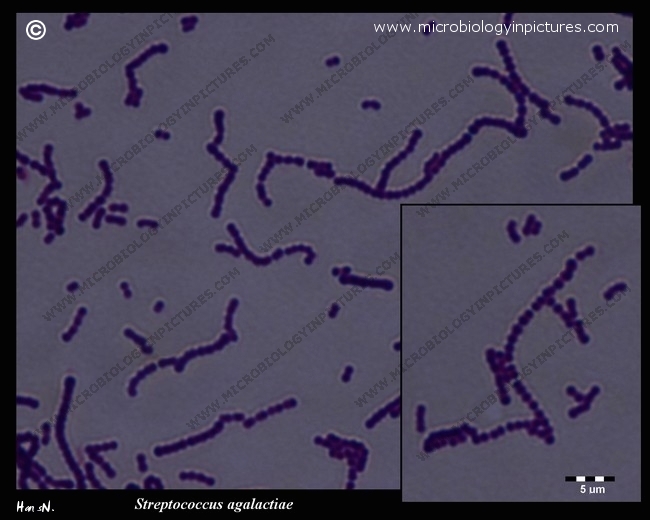 gram-positive cocci in chains